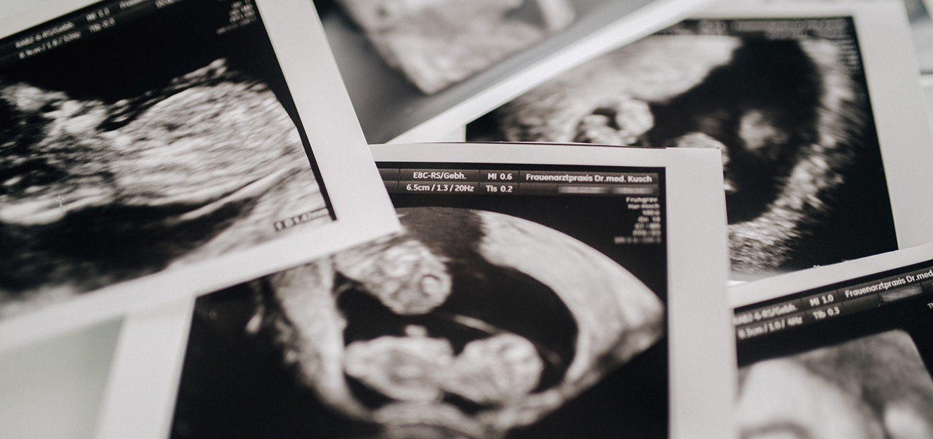 Schwangerschaft beim Frauenarzt in Fürth
